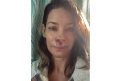 【衝撃】エヴァンジェリン・リリー、脳損傷の衝撃告白!