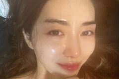 行きつけの皮膚科で深刻な火傷被害…女優クォン・ミナ、病院相手に民事・刑事訴訟を提起？