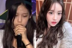 ヒップホップ少女から大人の雰囲気へ…人気ラッパーの率直な施術告白が再注目