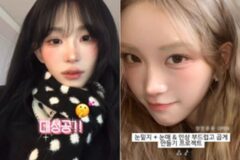 11歳年上男性との結婚を控え目元整形の過程をSNSで公開…「大成功」と満足感を表明